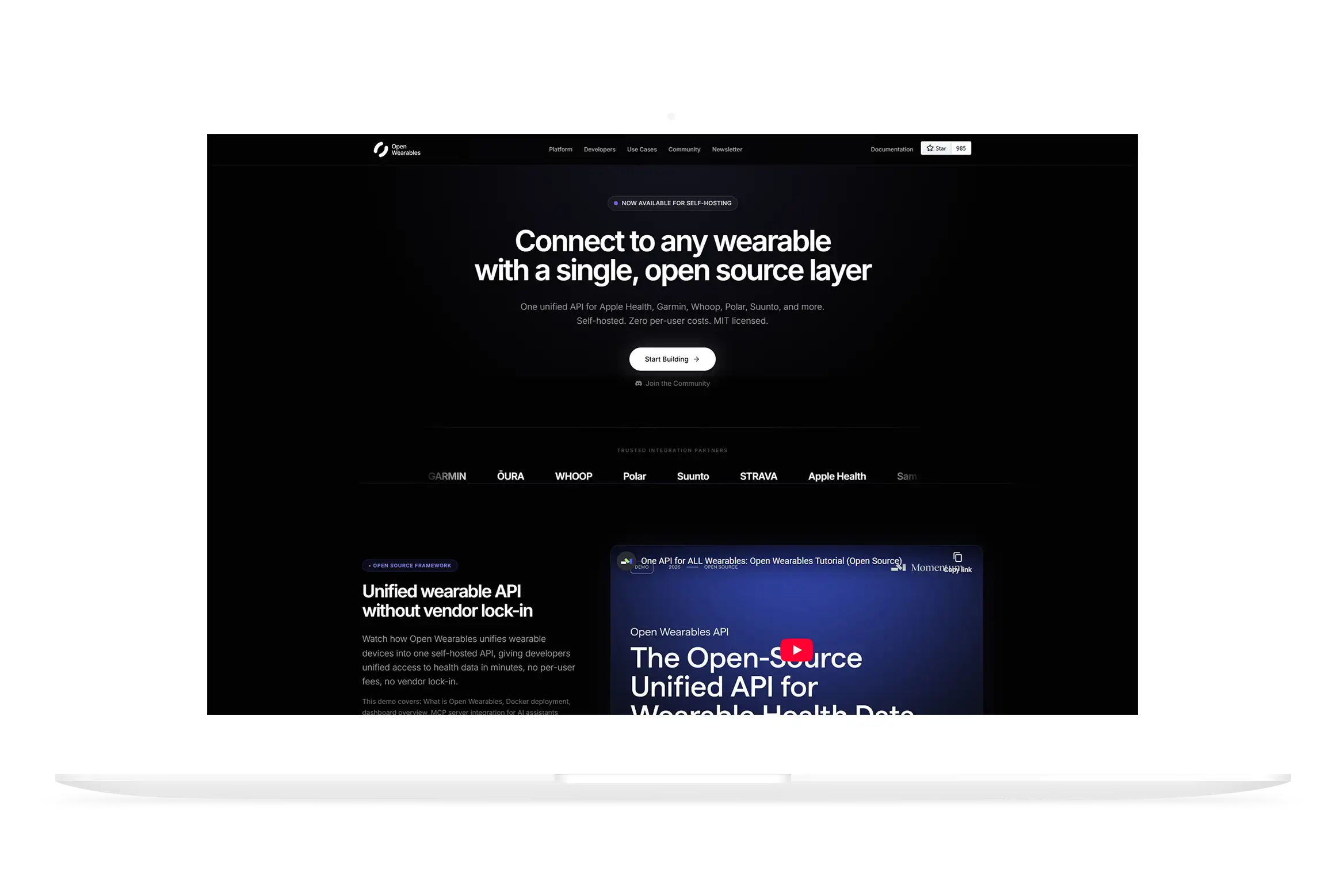 Open Wearables